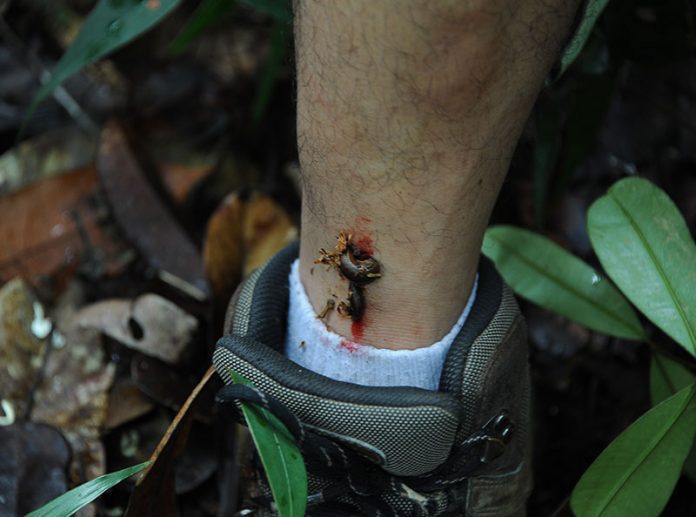 Cara Mengusir Lintah